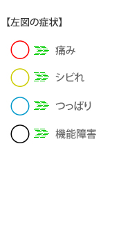 仕事 ヘルニア 頚椎 休む 椎間板 [mixi]今仕事休んでる方いますか?